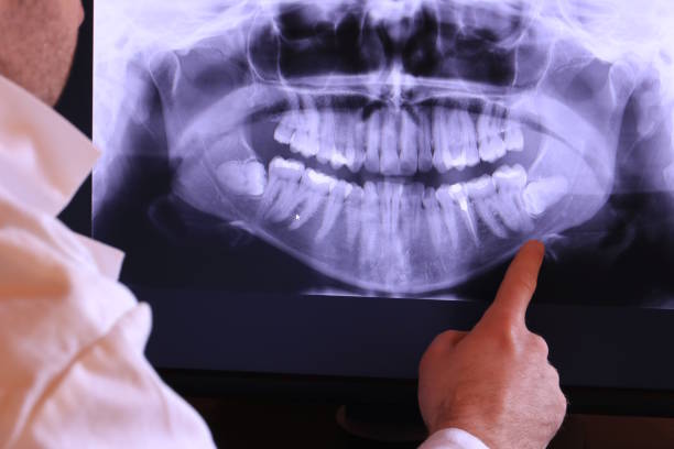 Best Emergency Dentist for Special Needs Patients in Santa Venetia, CA