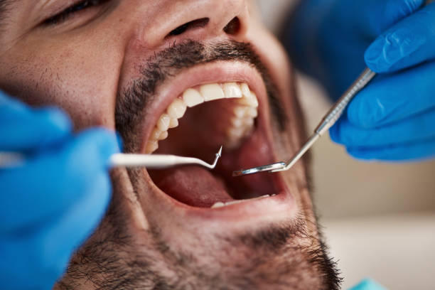 Best Emergency Dental Services for Seniors in Santa Venetia, CA