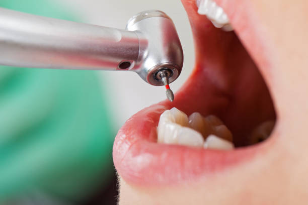 Best Mobile Emergency Dentist in Santa Venetia, CA